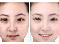 Phương pháp để sở hữu một làn da trắng hồng, không nám, không tàn nhang